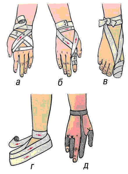 Типы бинтовых повязок рисунок